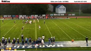 Receiver & Kicking team player contact each other during the kick causing ball to be touched by Receiving team (10-3-24)
