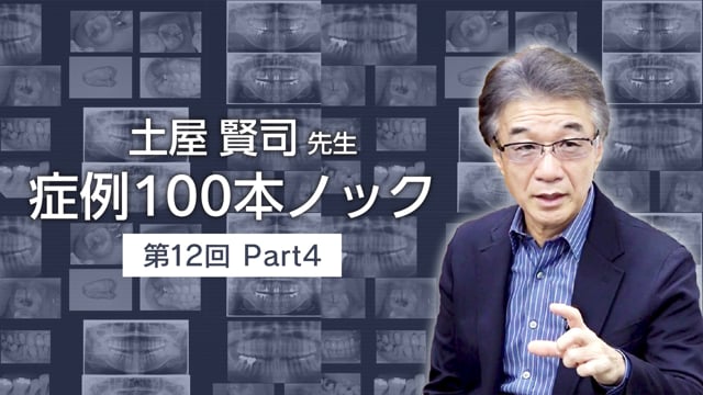 土屋賢司先生 症例100本ノック 第12回 PART4【期間限定プレミアム公開】