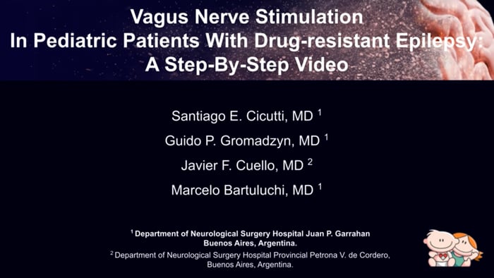 Vagus Nerve Stimulation