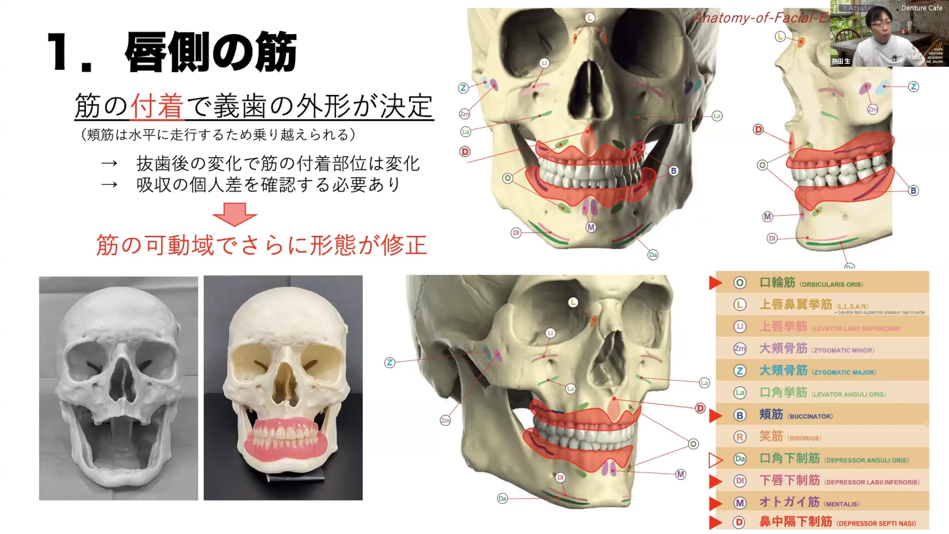 全部床義歯臨床に必要な解剖学を見直そう！Part4 ー唇側床縁形態を考えるー│Denture Cafe 第57回