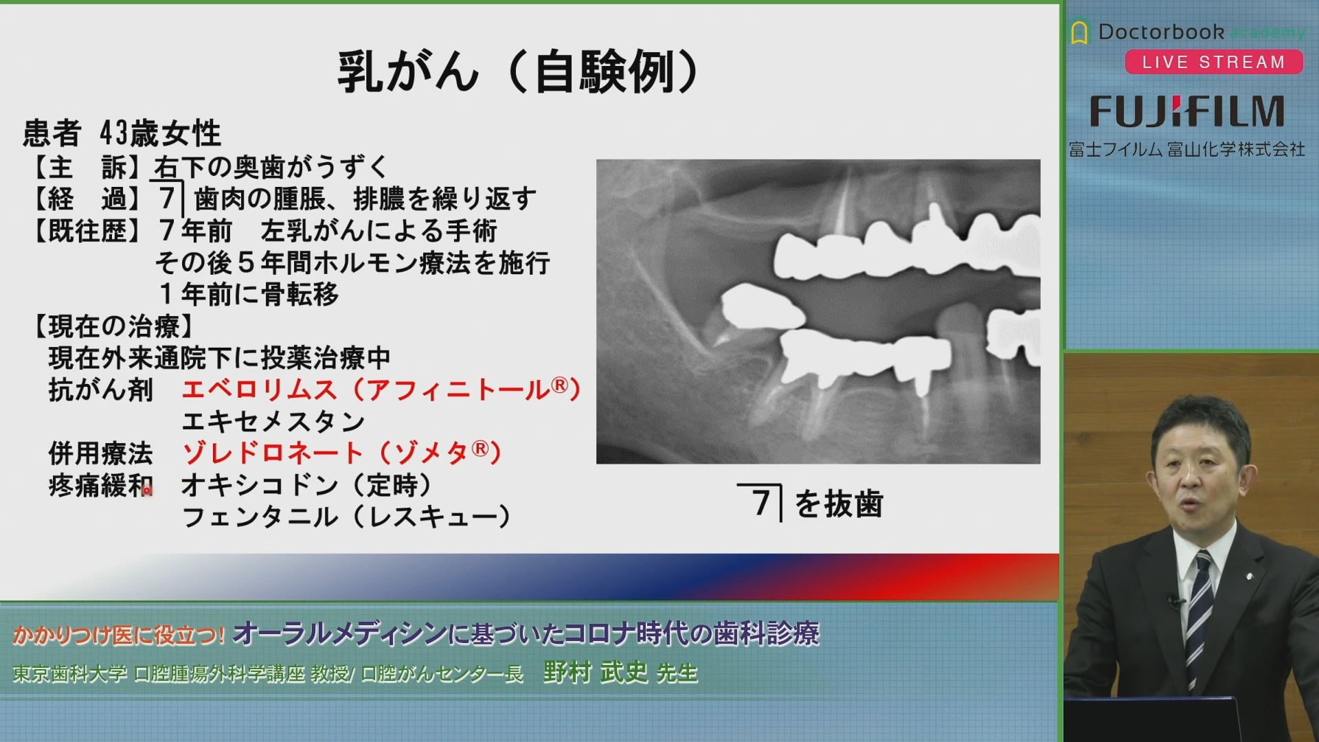  臨床知見録_口腔がん_AYA世代