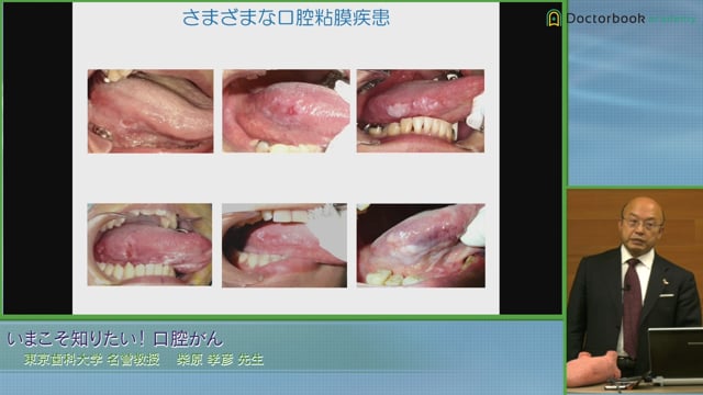  臨床知見録_口腔がん_さまざまな口腔粘膜疾患