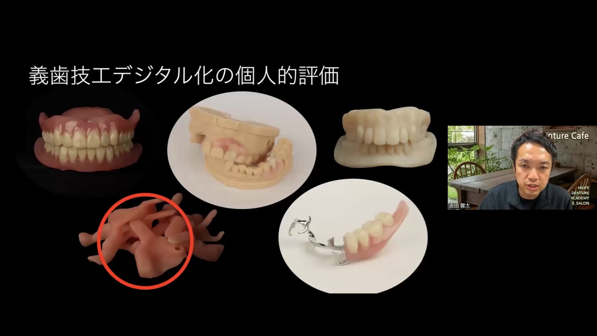 義歯技工のデジタル化、どこまで進んでる？│Denture Cafe 第55回