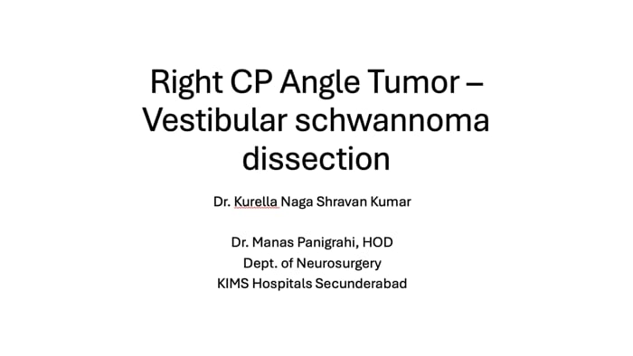 Right CP Angle Tumor- Vestibular Schwannoma Dissection