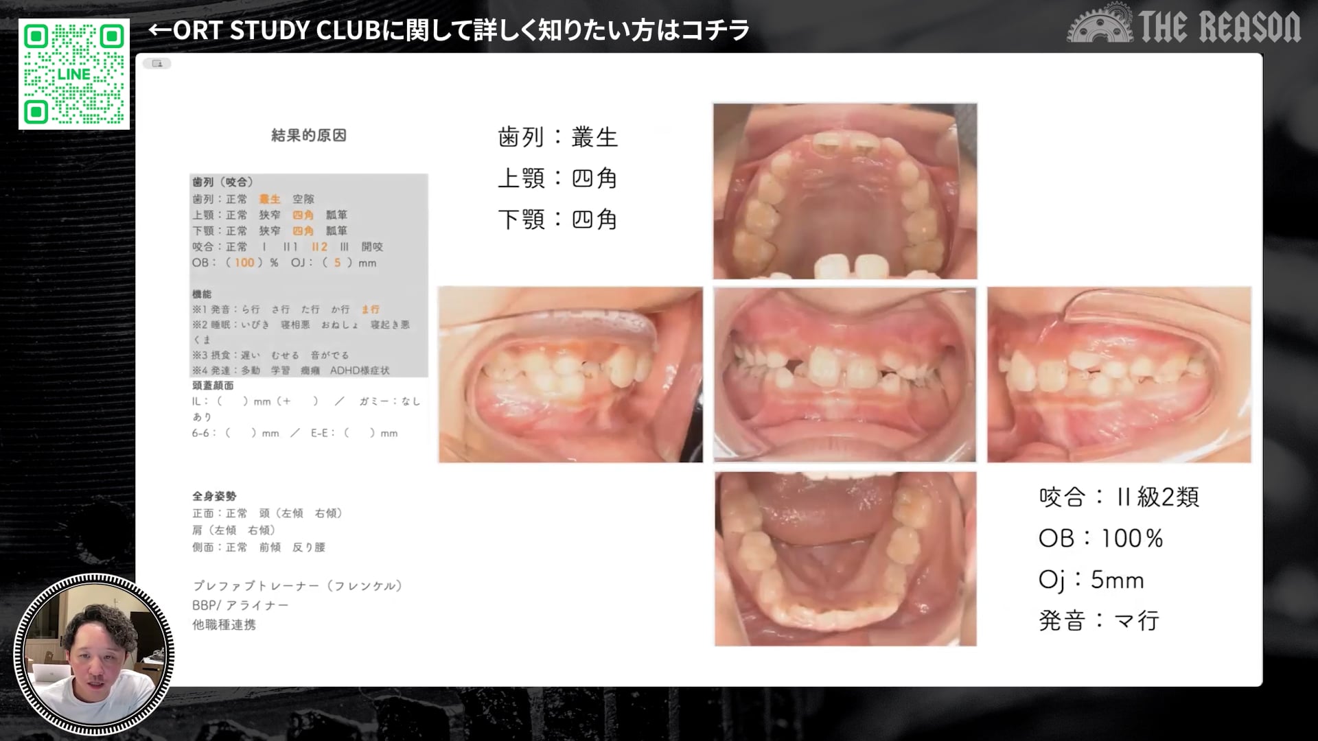 第20回 兄弟3人同時に治療を行った症例
