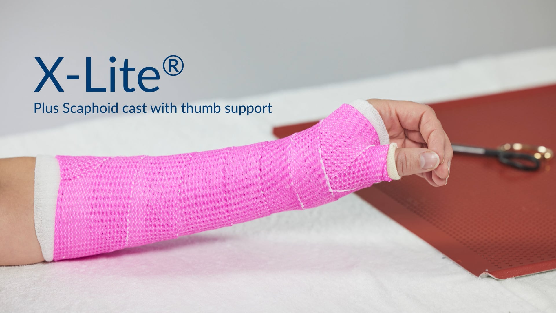 X-Lite® Plus: Scaphoid cast with thumb support