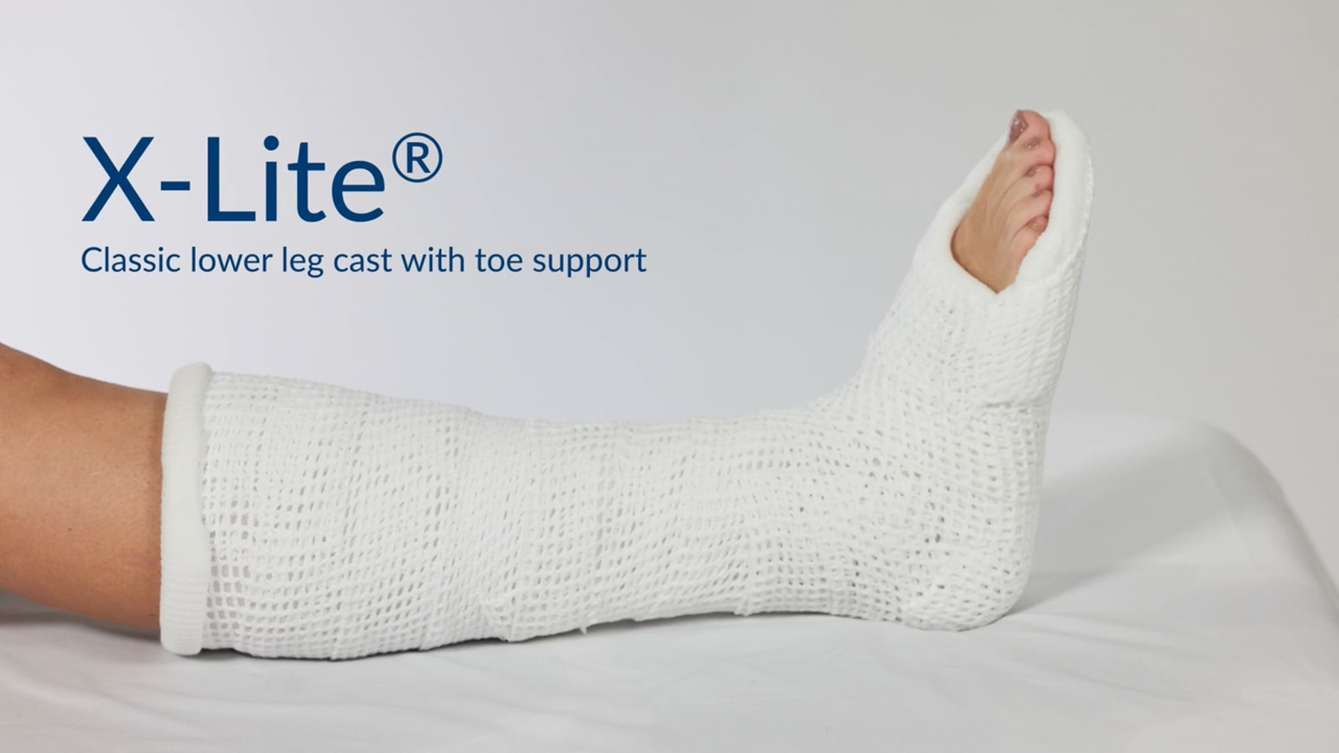 X-Lite® Classic: Lower leg cast with toe support