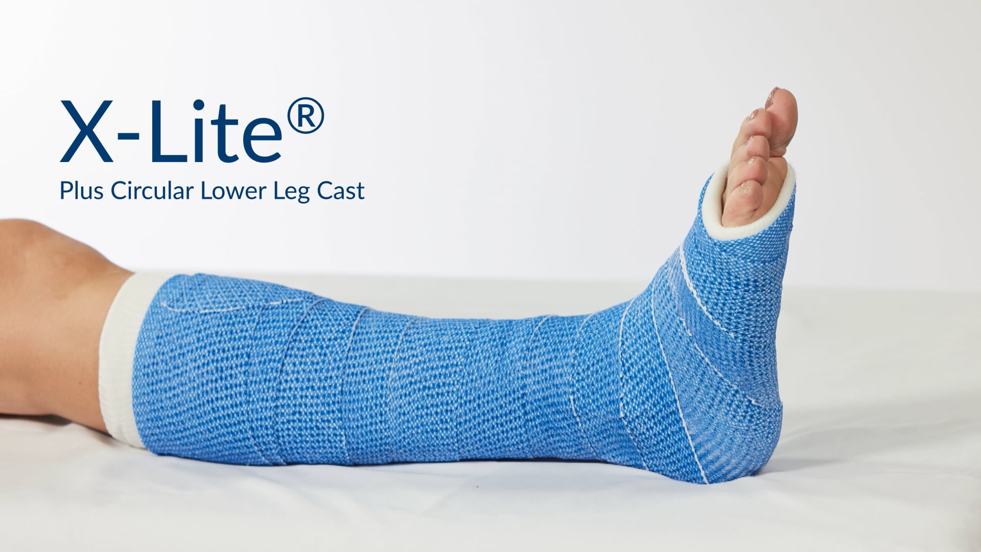 X-Lite® Plus: Lower leg cast