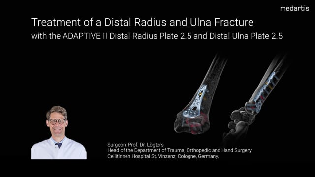OP-Video Distale Radius- und Ulnafraktur – Medizinische Videos von A-ZED Videography
