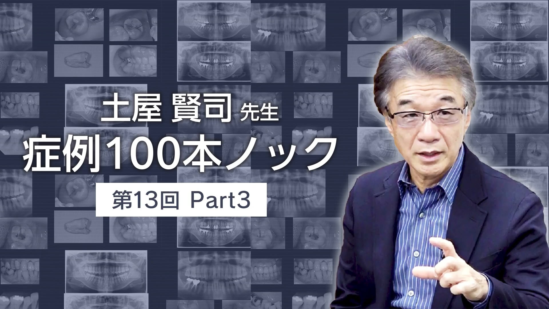 土屋賢司先生 症例100本ノック 第13回 PART3【期間限定プレミアム公開】