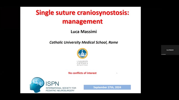 Craniofacial – Principles Of Management Of Craniosynostosis (Simple)