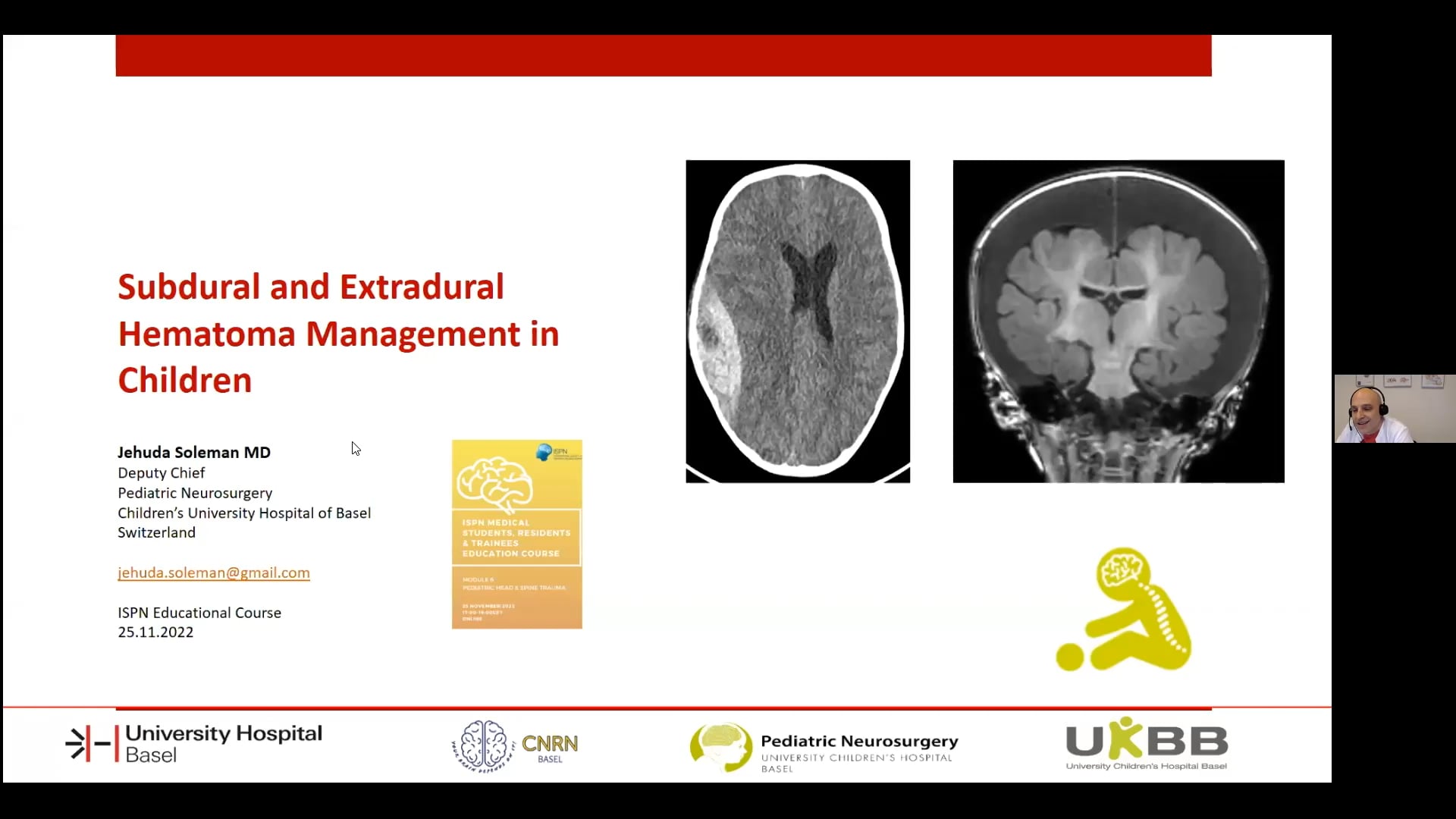 Subdural and Extra Dural Hematoma Managemen