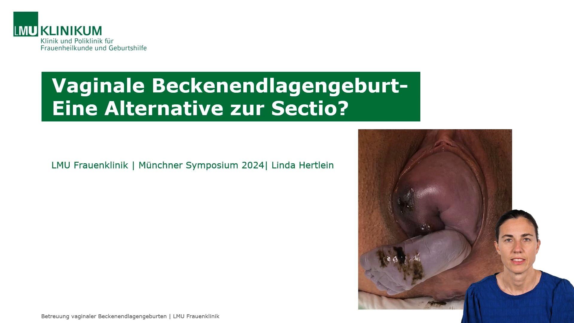 Thumbnail von Vaginale Beckenendlagengeburt: Eine Alternative zur Sectio? 