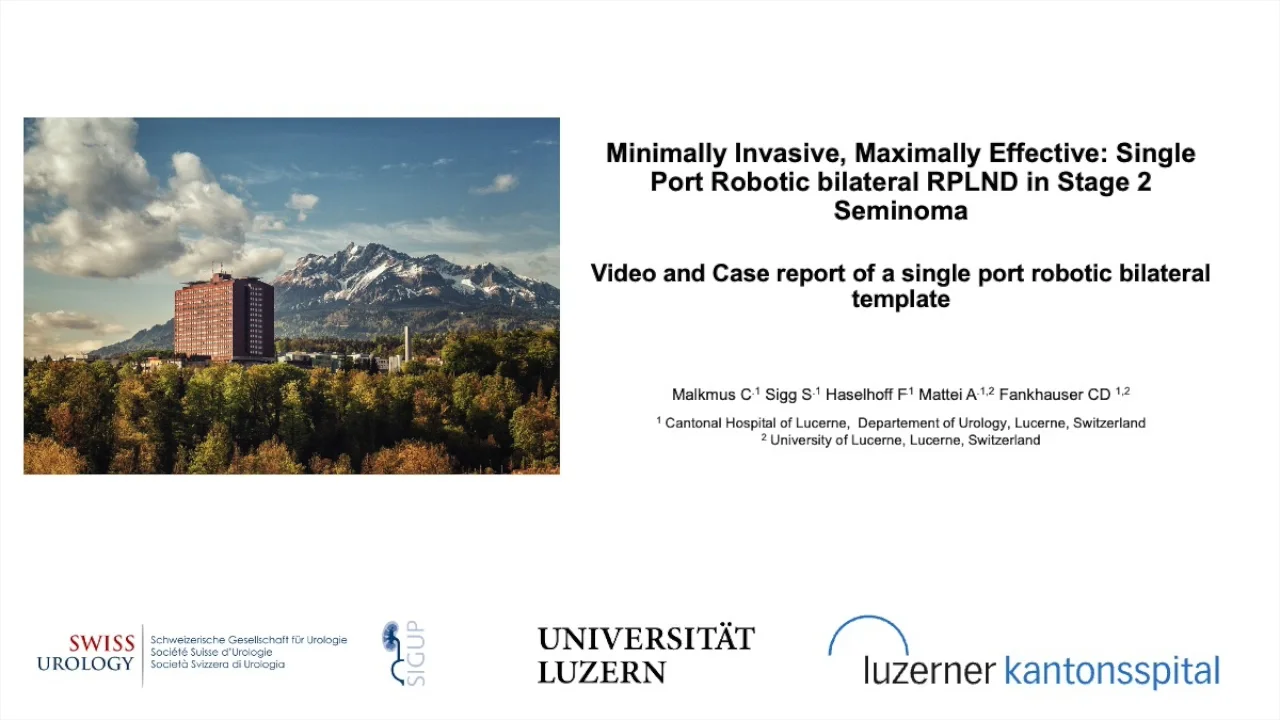 AM25-1355-RPLND Single Port EAU.mp4