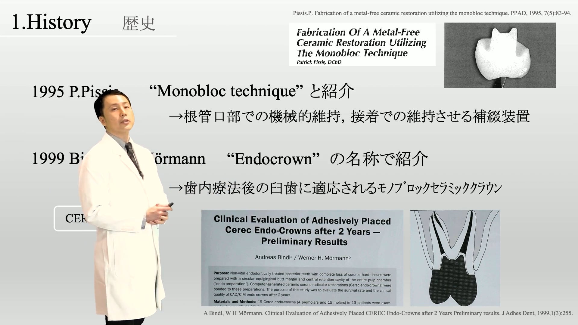 エンドクラウンの基礎知識と臨床のポイント〜 2024年診療報酬改定の新増項目「エンドクラウン」を解説！〜