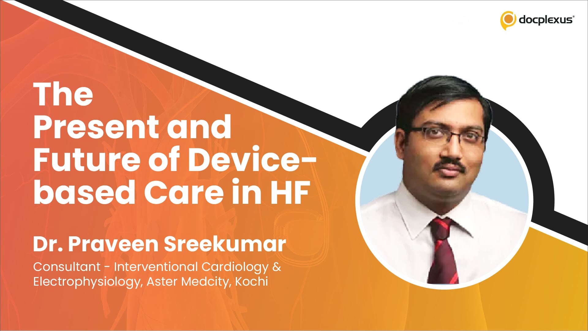 The Present and Future of Device-based Care in HF