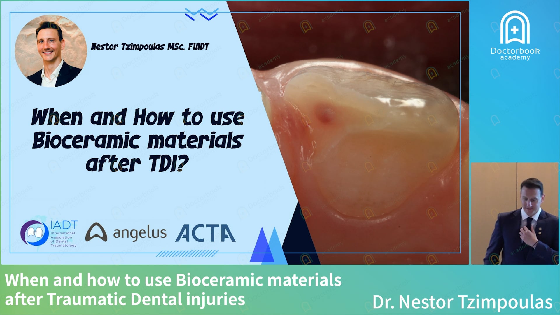 When and how to use Bioceramic materials after Traumatic Dental injuries 