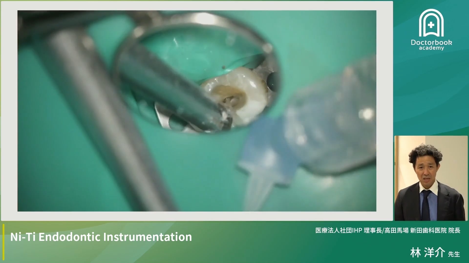 Ni-Ti Endodontic Instrumentation　効率的に根管形成を終わらせるための交通整理