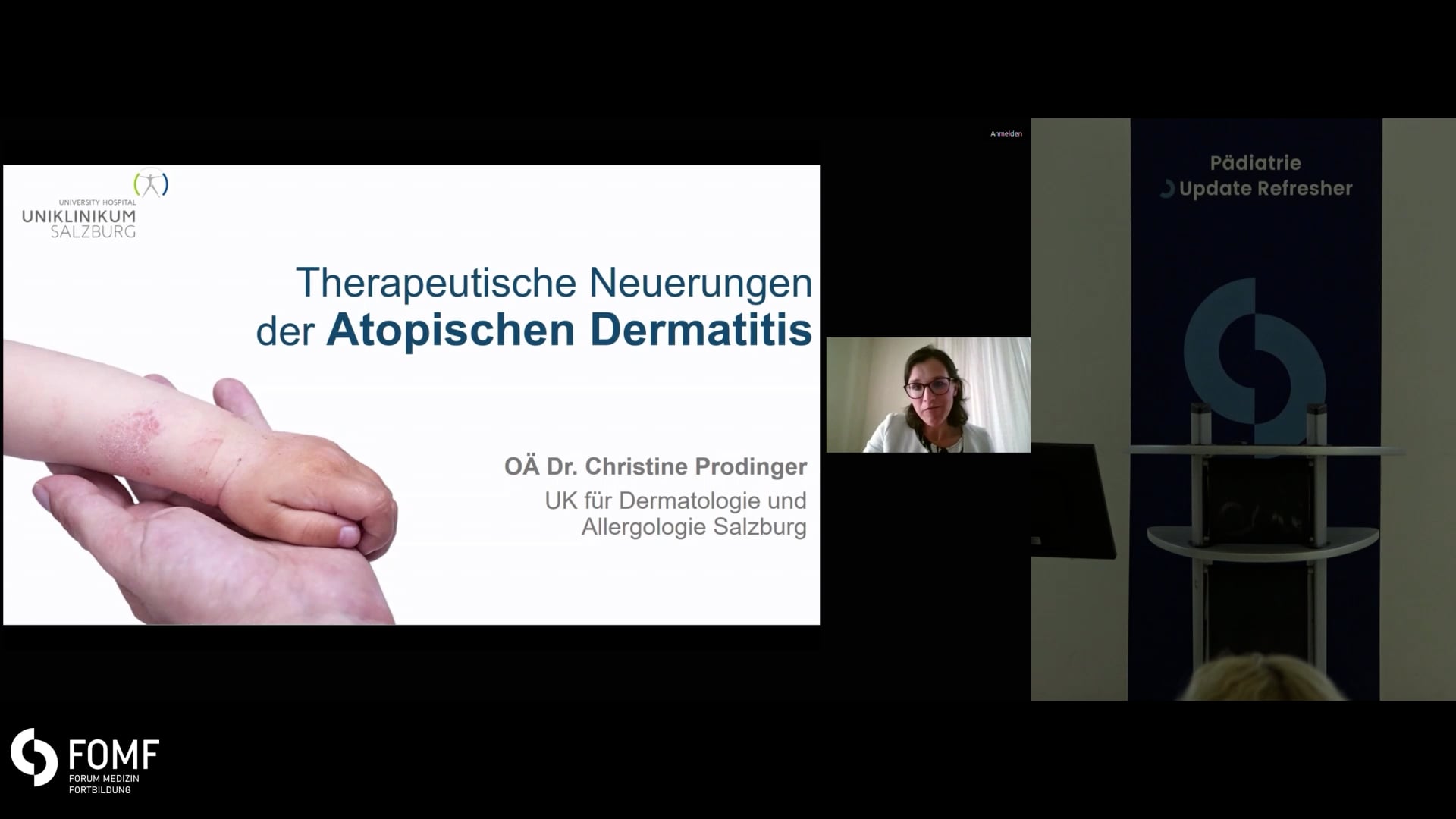 Therapeutische Neuerungen der Atopischen Dermatitis 