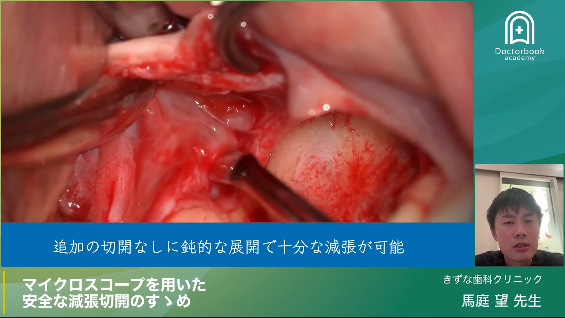 マイクロスコープを用いた安全な減張切開のすゝめ