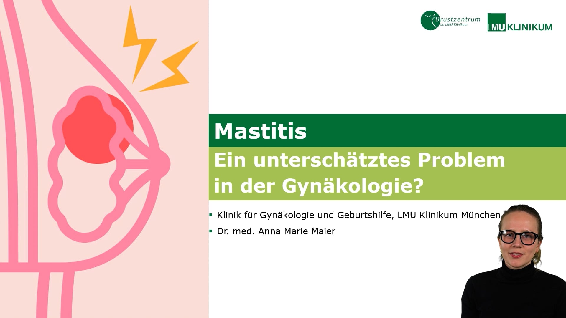 Thumbnail von Mastitis - Ein unterschätztes Problem in der Gynäkologie?