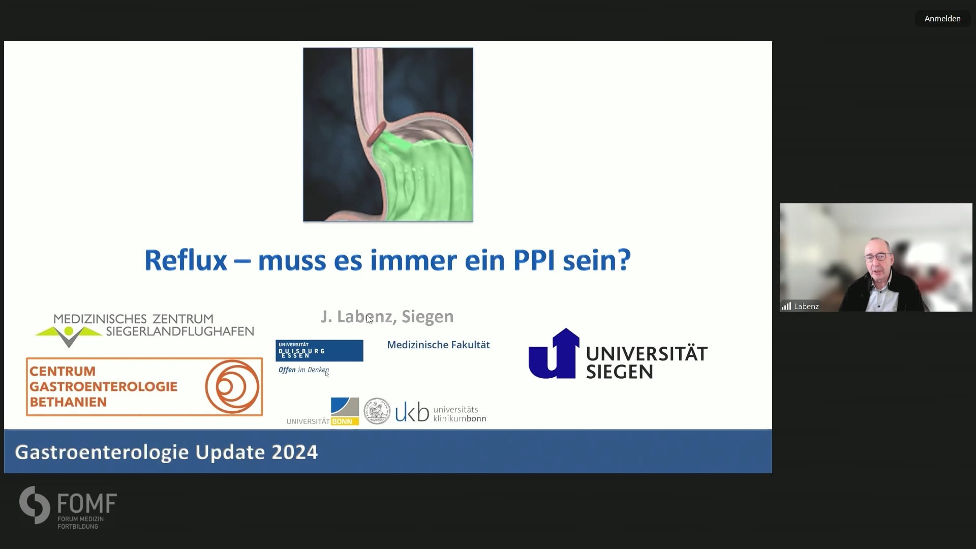 Reflux – muss es immer ein PPI sein?