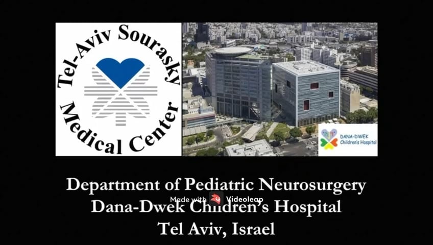 How I do it: Segittal Craniosynostosis; Wide, Early Craniotomy