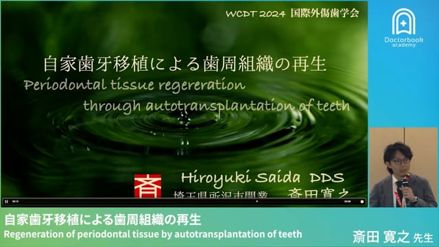 自家歯牙移植による歯周組織の再生  Regeneration of periodontal tissue by autotransplantation of teeth