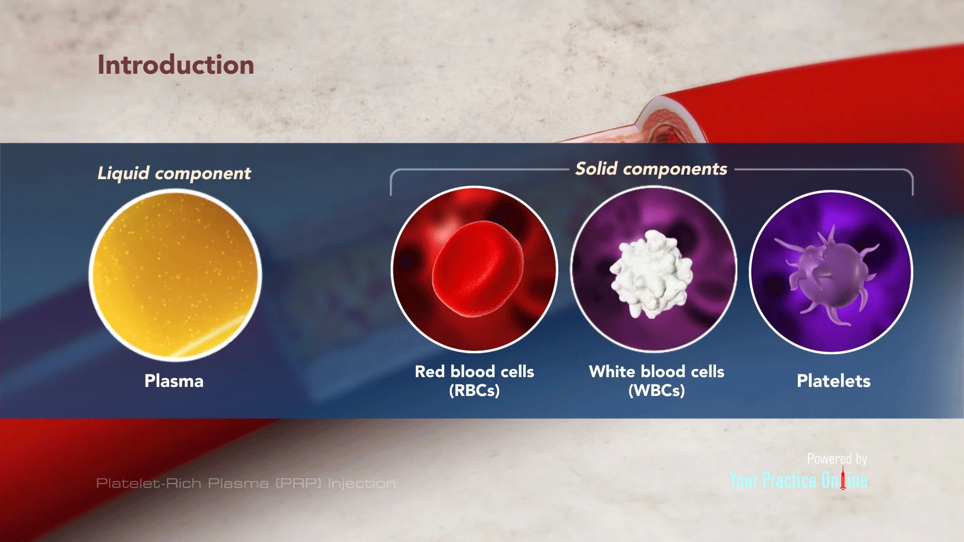 Platelet Rich Plasma (PRP) Injection Marietta | Tendon