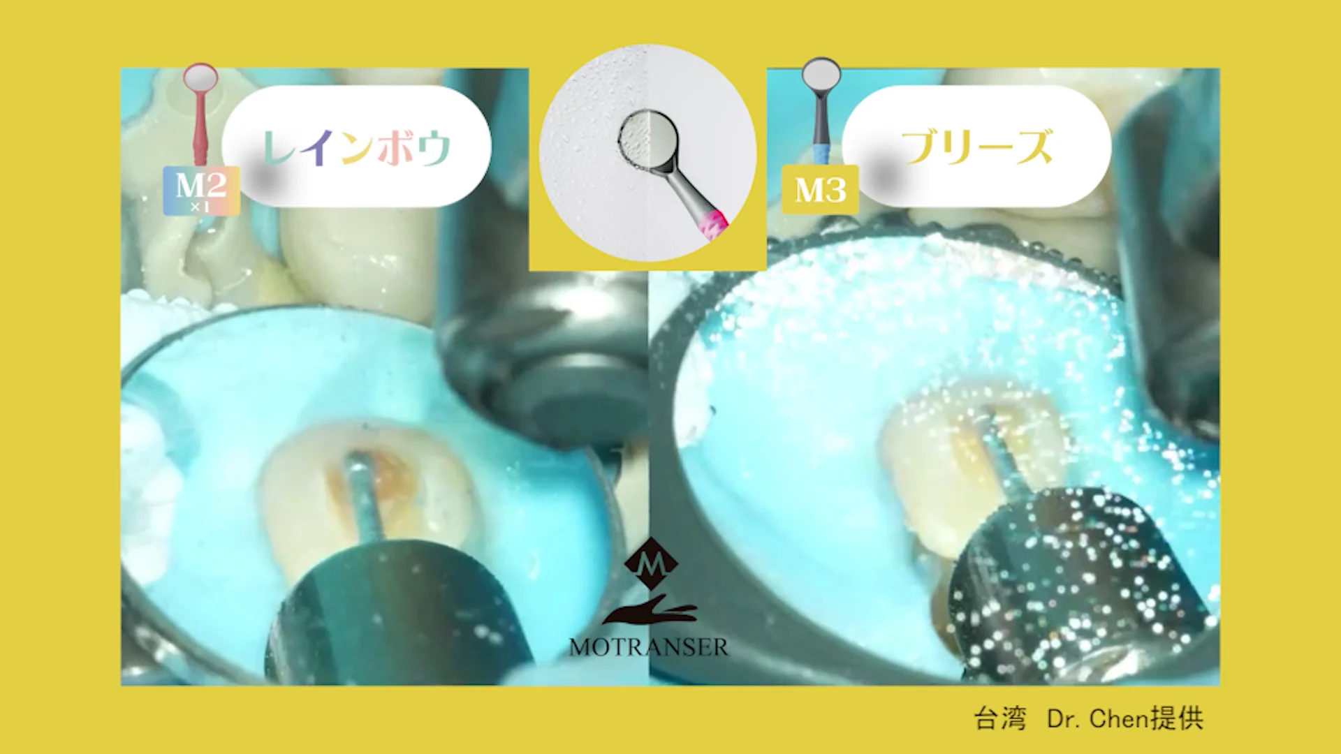 陸一飛 山水 モトランサー デンタルミラー | 白水貿易株式会社