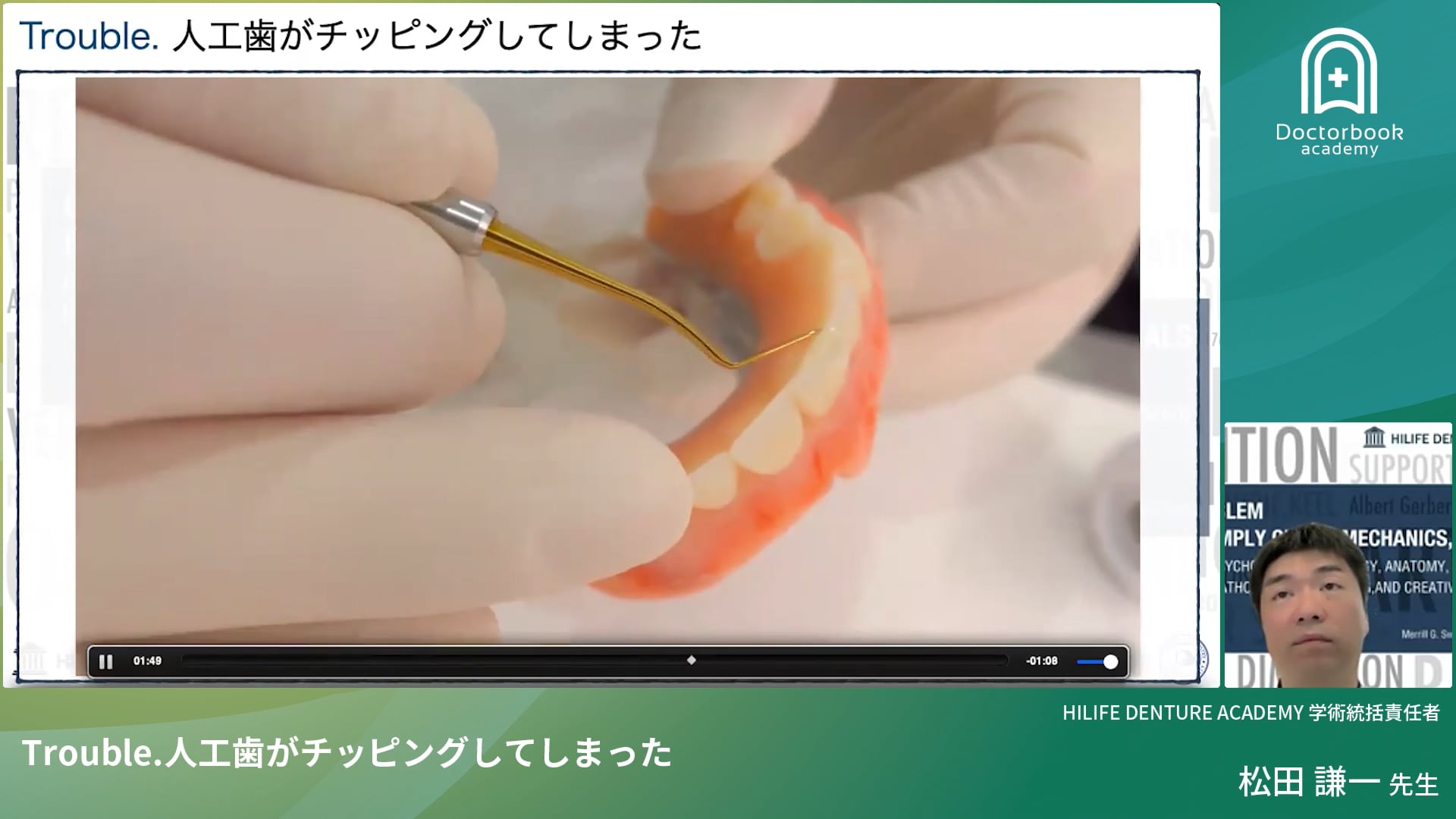 Trouble. 人工歯がチッピングしてしまった | Doctorbook academy Trouble. 人工歯がチッピングしてしまった | Doctorbook academy