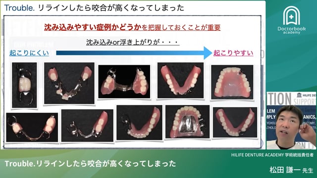 Trouble. リラインしたら咬合が高くなってしまった