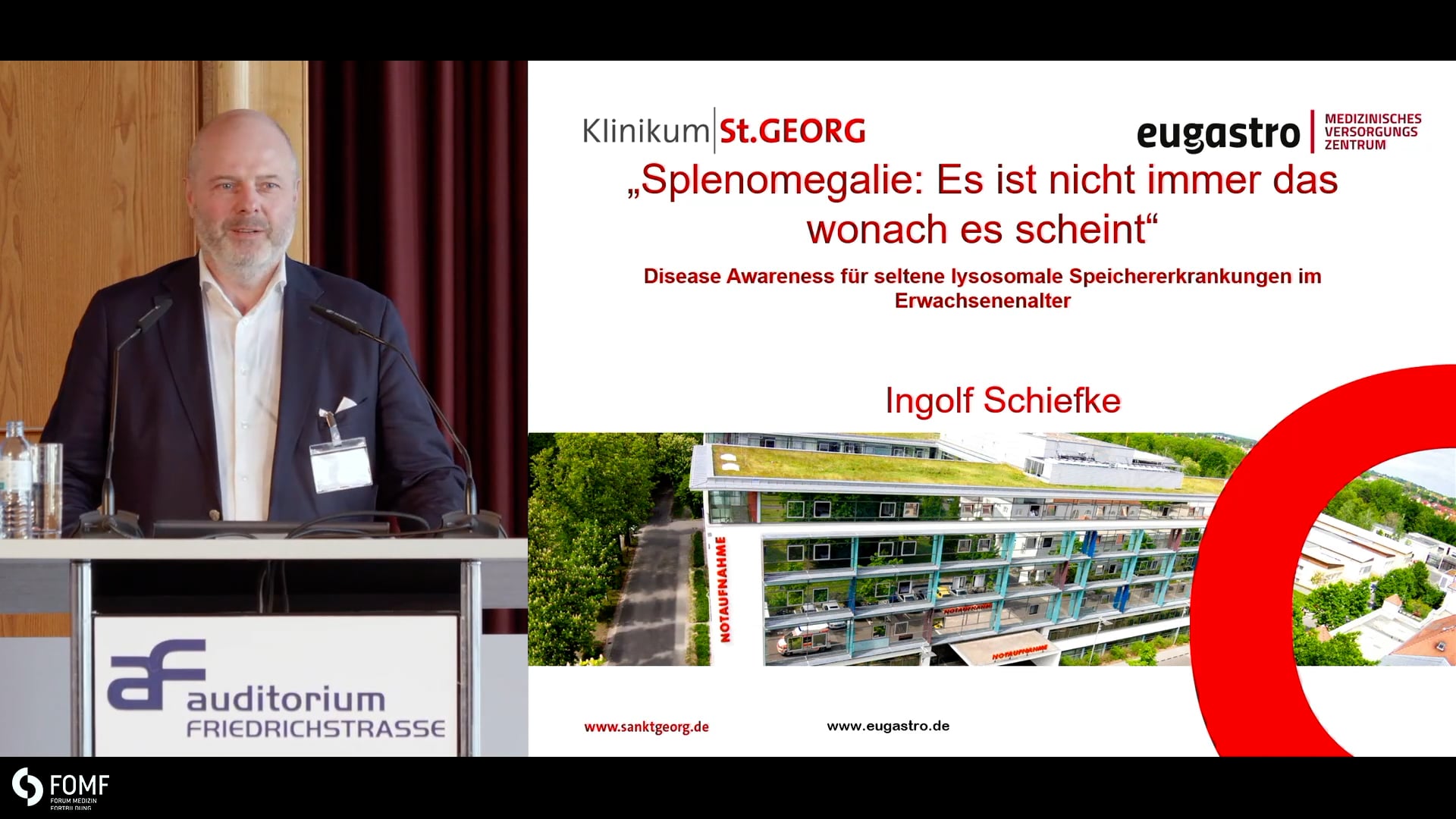 Splenomegalie: Es ist nicht immer das wonach es scheint