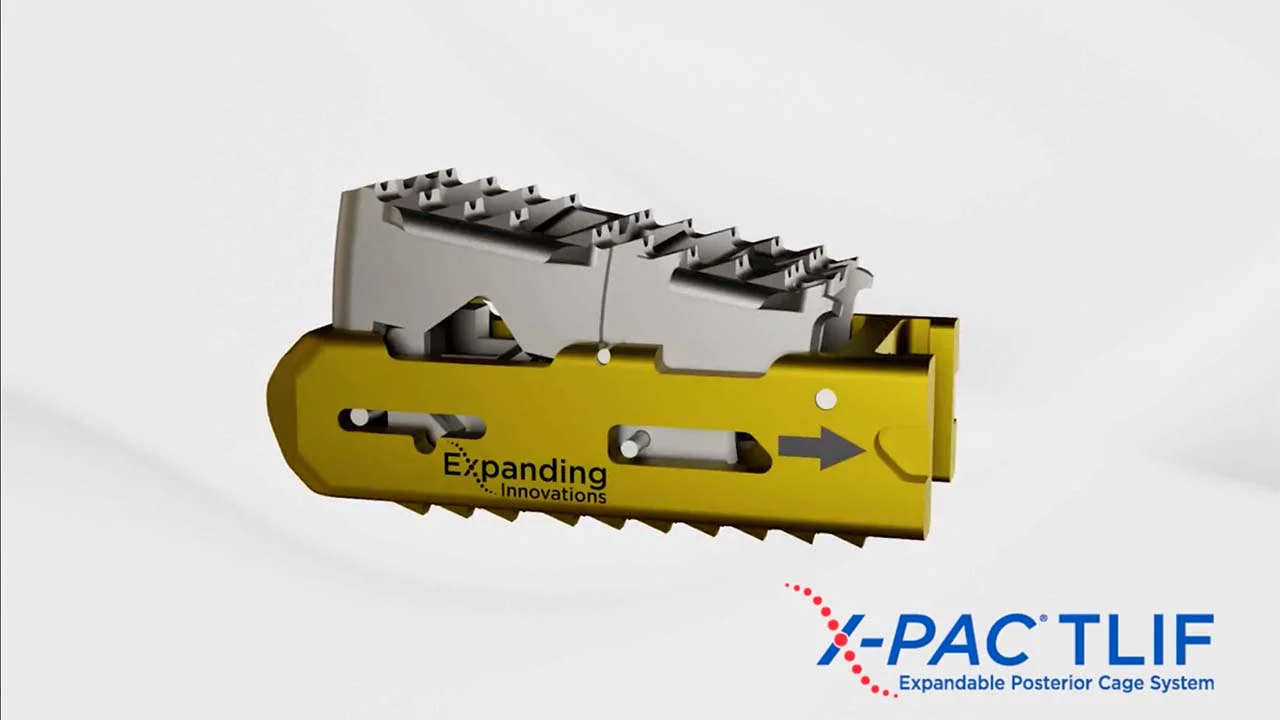 X-PAC TLIF - Expanding Innovations, Inc. (EI)