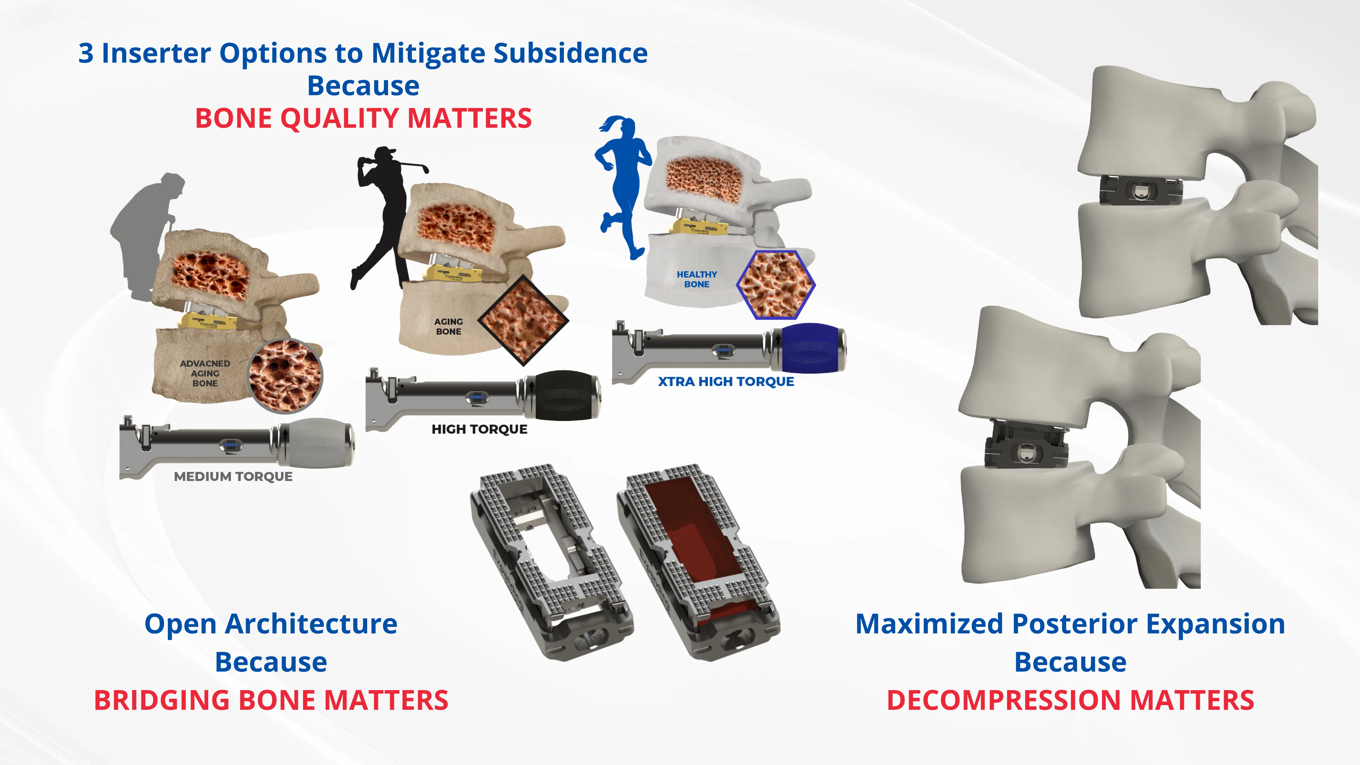 X-PAC TLIF - Expanding Innovations, Inc. (EI)