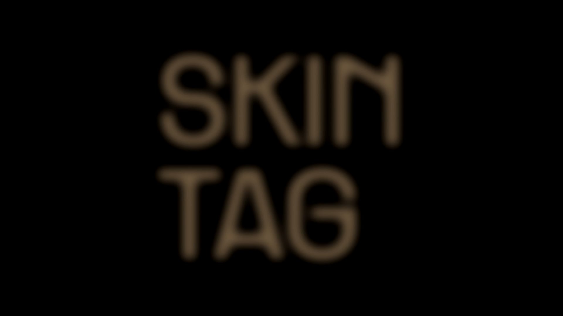 Skin Tag | Teaser