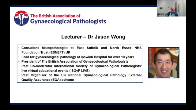 Ovarian Tumours, Dr Jason Wong