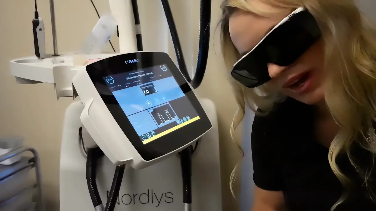 Ipl Ellipse Ipl Para Acne Opiniones Facial Tratamiento Laser Ipl