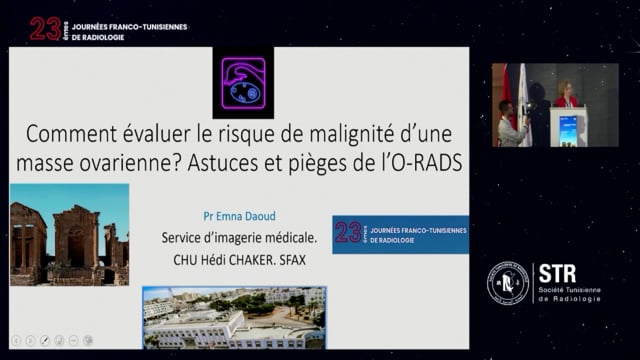 Comment évaluer le risque de malignité d'une masse ovarienne: astuces et pièges de l’O-RAADS?