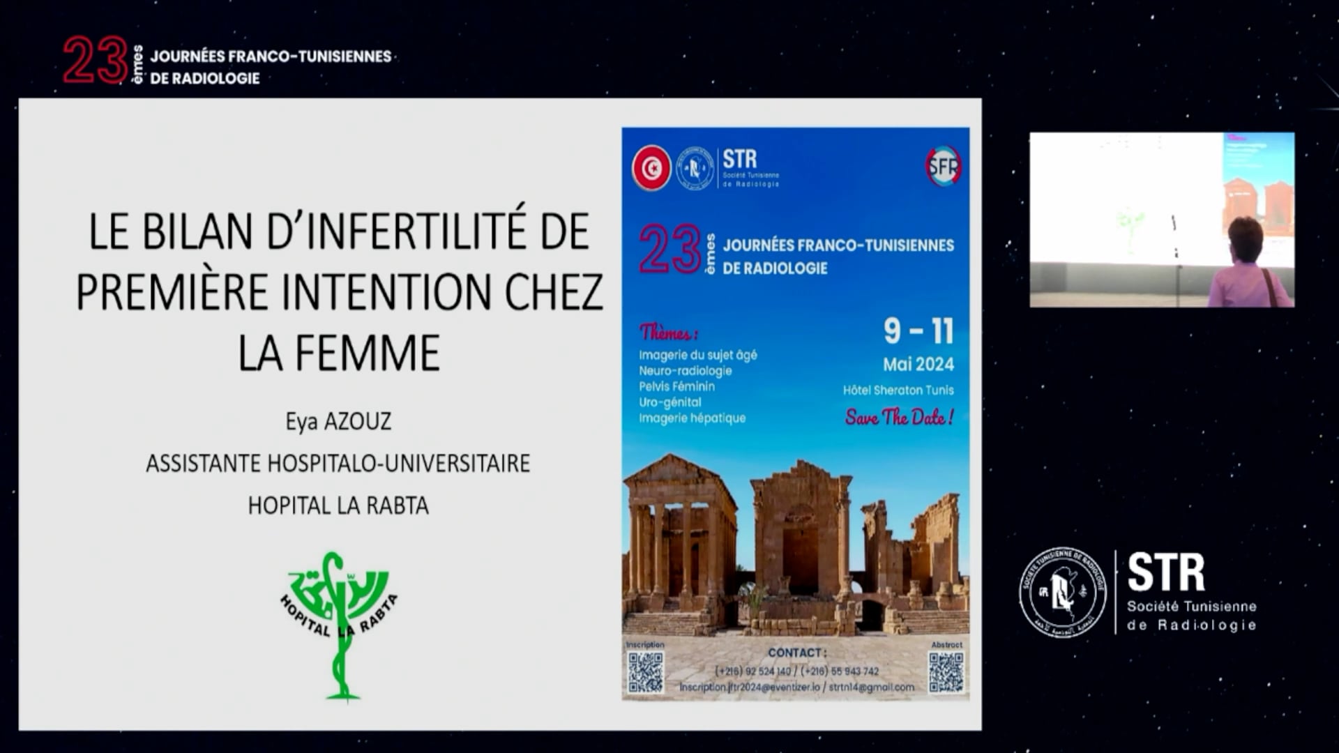 Imagerie d’infertilité de 1ère intention : Échographie , Hystérosonographie et hystérosalpingographie