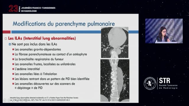  Imagerie du thorax chez le sujet âgé : pousser les frontières du normal