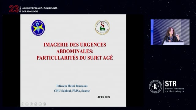 Imagerie des urgences abdominales : particularités du sujet âgé 