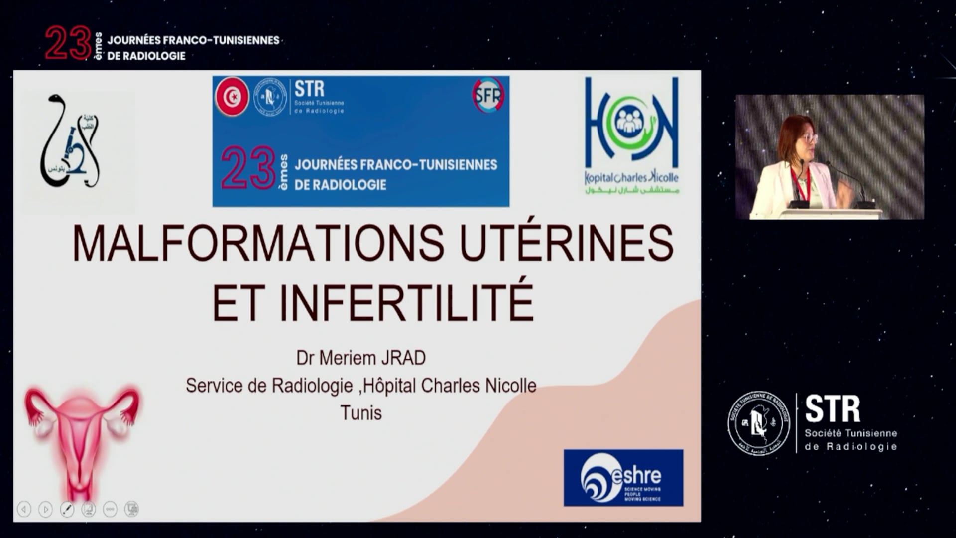  Malformations utéro-vaginales et fertilité
