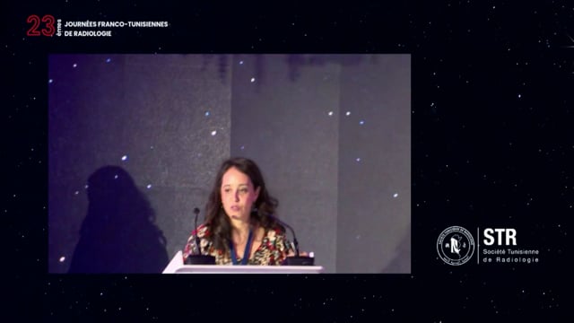 Thrombectomie mécanique (atelier sur simulateur)