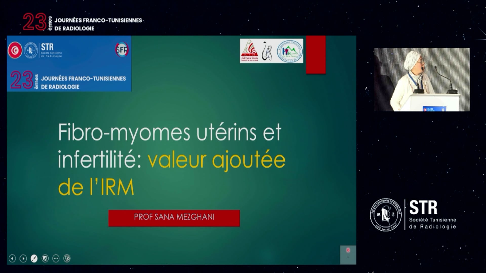 Fibromyomes utérins et infertilité : valeur ajoutée de l’IRM