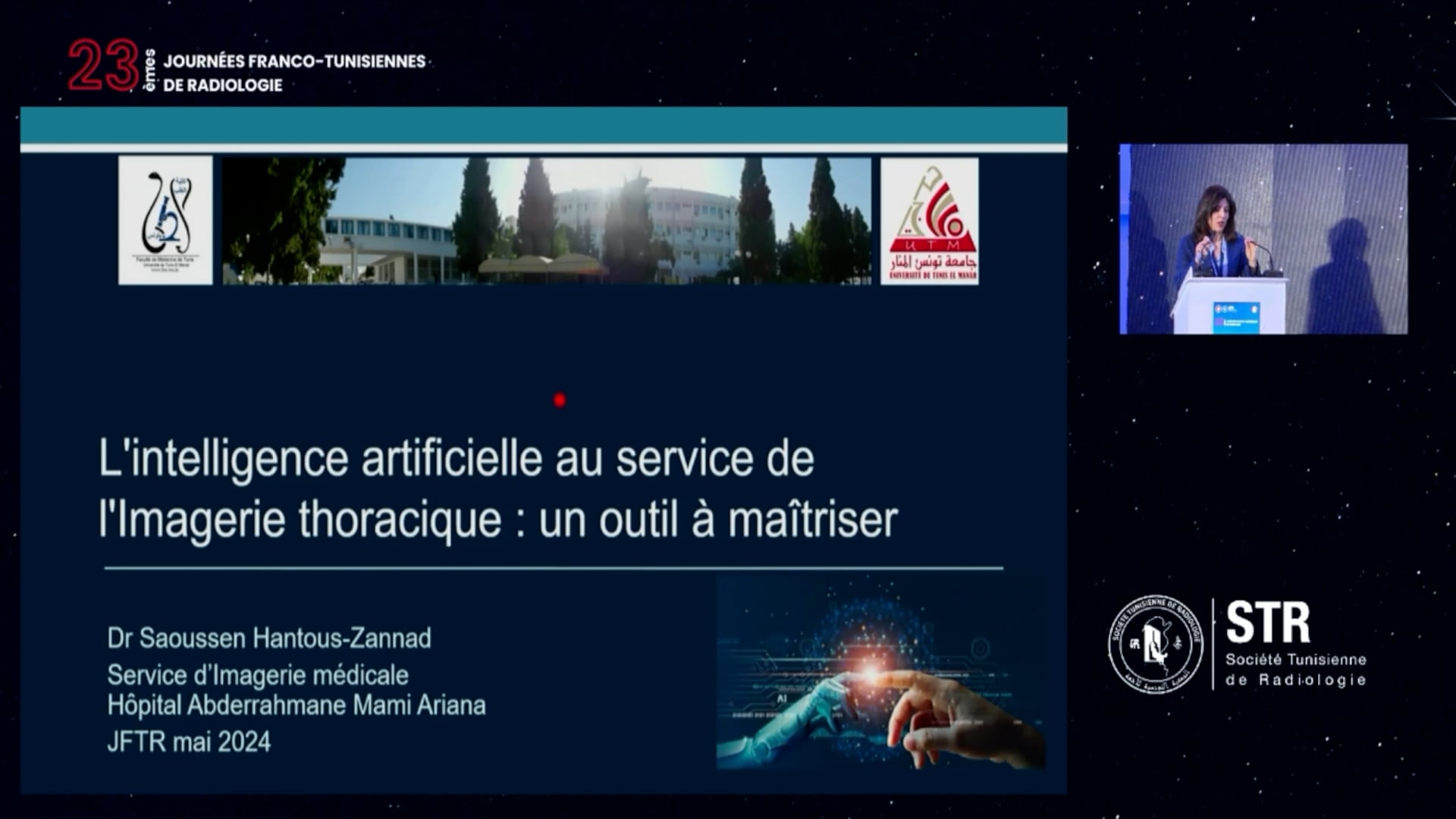  L'IA au service de l'Imagerie thoracique : un outil à maîtriser