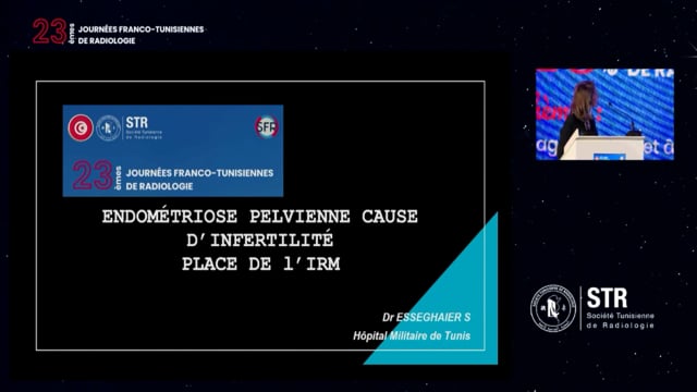  Endométriose cause d'infertilité