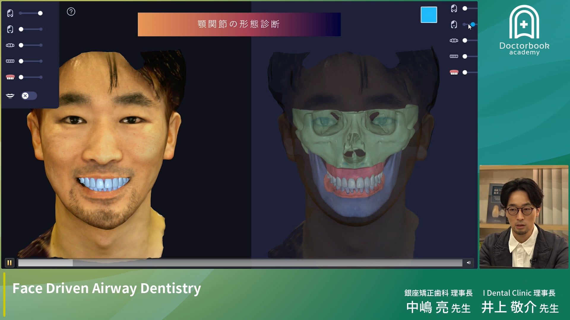 Face Driven Airway Dentistry 〜顔貌と気道を考慮したこれからの歯科医療〜【1月20日までプレミアム公開】