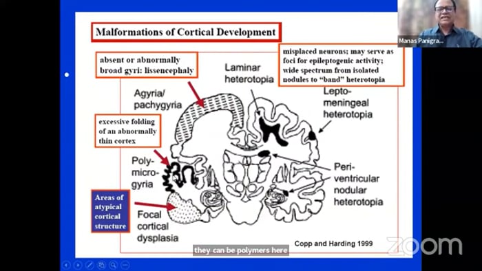 Epilepsy Surgery - Full sessioin