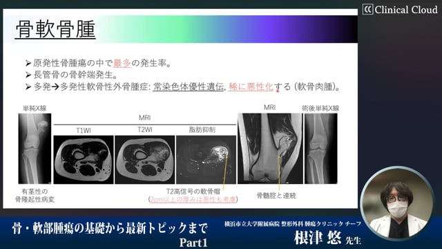 骨・軟部腫瘍の基礎から最新トピックまでPart1-希少がんとしての悪性骨軟部腫瘍と診療の基礎-